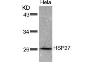 Image no. 1 for anti-Heat Shock 27kDa Protein 1 (HSPB1) (AA 76-80) antibody (ABIN197489) (HSP27 抗体  (AA 76-80))