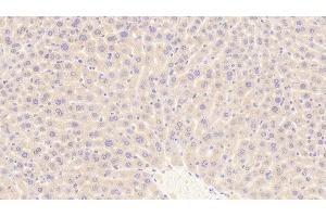 Detection of TFR in Mouse Liver Tissue using Polyclonal Antibody to Transferrin Receptor (TFR) (Transferrin Receptor 抗体  (AA 572-757))