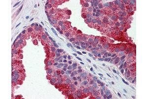 Anti-APEH antibody IHC of human prostate. (APEH 抗体  (AA 144-193))