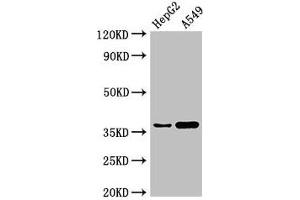 Western Blot Positive WB detected in: HepG2 whole cell lysate, A549 whole cell lysate All lanes: GGH antibody at 3 μg/mL Secondary Goat polyclonal to rabbit IgG at 1/50000 dilution Predicted band size: 36 kDa Observed band size: 36 kDa (GGH 抗体  (AA 219-293))