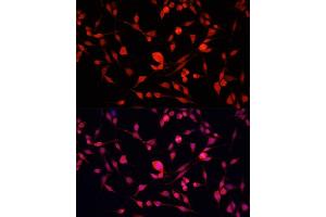 Immunofluorescence analysis of NIH/3T3 cells using YB-1/YB-1/YBX1 antibody (ABIN7271411) at dilution of 1:100. (YBX1 抗体  (AA 100-200))