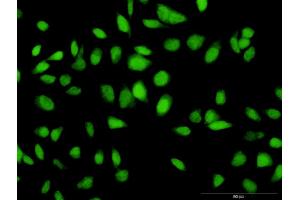 Immunofluorescence of purified MaxPab antibody to C12orf24 on HeLa cell. (C12ORF24 抗体  (AA 1-273))