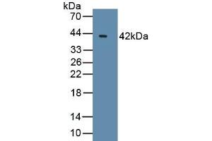 Detection of Recombinant Bcl7A, Human using Polyclonal Antibody to B-Cell CLL/Lymphoma 7A (Bcl7A) (BCL7A 抗体  (AA 1-210))