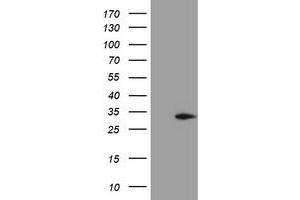 Western Blotting (WB) image for anti-Methylmalonic Aciduria (Cobalamin Deficiency) CblC Type, with Homocystinuria (MMACHC) antibody (ABIN1499510) (MMACHC 抗体)
