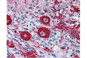 Immunohistochemistry (IHC) image for anti-Vascular Endothelial Zinc Finger 1 (VEZF1) (Middle Region) antibody (ABIN2776482)