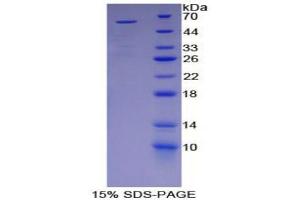SDS-PAGE (SDS) image for Killer Cell Immunoglobulin-Like Receptor 2DS2 (KIR2DS2) (AA 22-304) protein (His tag,GST tag) (ABIN1879183) (KIR2DS2 Protein (AA 22-304) (His tag,GST tag))