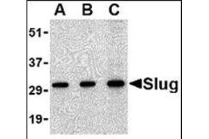 Western blot analysis of Slug in 293 cell lysate with this product at in (A) 0. (SLUG 抗体  (Center))