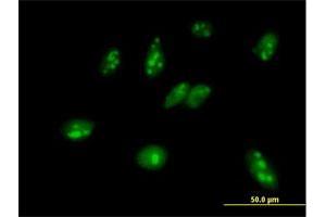 Immunofluorescence of purified MaxPab antibody to MPHOSPH6 on HeLa cell. (MPHOSPH6 抗体  (AA 1-160))