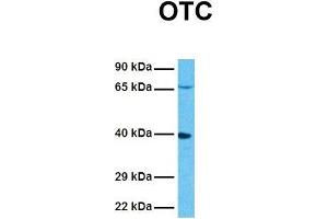 Western Blotting (WB) image for anti-Ornithine Carbamoyltransferase (OTC) (N-Term) antibody (ABIN2773791)