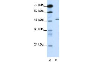 GABRB2 antibody used at 0. (GABRB2 抗体)