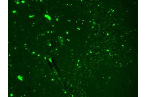 Immunohistochemistry (IHC) image for anti-Sodium Channel, Voltage-Gated, Type IX, alpha Subunit (SCN9A) (AA 1751-1946) antibody (HRP) (ABIN2483099)