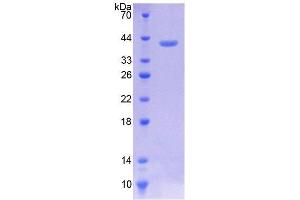 SDS-PAGE analysis of Human Mucin 3 Protein. (MUC3A 蛋白)