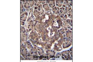 Immunohistochemistry (Paraffin-embedded Sections) (IHC (p)) image for anti-Recombination Signal Binding Protein For Immunoglobulin kappa J Region-Like (RBPJL) (AA 8-36), (N-Term) antibody (ABIN655981)