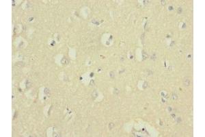Immunohistochemistry of paraffin-embedded human brain tissue using ABIN7161138 at dilution of 1:100 (UBE2F 抗体  (AA 1-185))