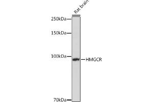Western Blotting (WB) image for anti-3-Hydroxy-3-Methylglutaryl-CoA Reductase (HMGCR) (AA 629-888) antibody (ABIN3022294)