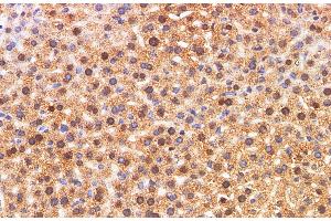 Immunohistochemistry of paraffin-embedded Mouse liver using S100A11 Polyclonal Antibody at dilution of 1:200 (S100A11 抗体)