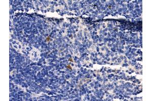 ABIN6259651 and ABIN6268999 at 1/100 staining Mouse spleen tissue by IHC-P. (Serotonin Receptor 1A 抗体  (Internal Region))
