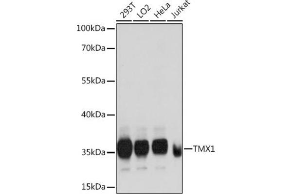 TMX1 抗体  (AA 210-280)
