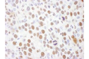 Immunohistochemistry (IHC) image for anti-RAD17 (RAD17) (pSer645) antibody (ABIN7449387) (RAD17 抗体  (pSer645))