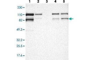 Western blot analysis of Lane 1: RT-4, Lane 2: U-251 MG, Lane 3: Human Plasma, Lane 4: Liver, Lane 5: Tonsil with VEZT polyclonal antibody  at 1:250-1:500 dilution. (VEZT 抗体)