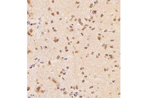 Immunohistochemistry (Paraffin-embedded Sections) (IHC (p)) image for anti-Wolf-Hirschhorn Syndrome Candidate 1-Like 1 (WHSC1L1) antibody (ABIN7076233)
