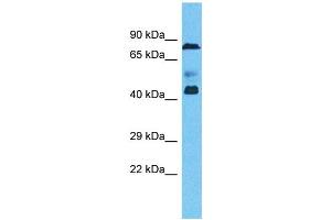 Host:  Rabbit  Target Name:  ZNF362  Sample Type:  Ovary Tumor lysates  Antibody Dilution:  1. (ZNF362 抗体  (N-Term))