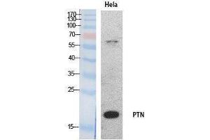 Western Blotting (WB) image for anti-Pleiotrophin (PTN) (Internal Region) antibody (ABIN3178535) (Pleiotrophin 抗体  (Internal Region))