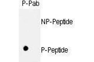 Dot blot analysis of anti-hRb- Phospho-specific Pab (ABIN389648 and ABIN2839638) on nitrocellulose membrane. (Retinoblastoma 1 抗体  (pSer811))