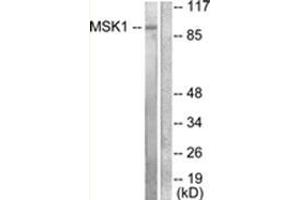 Western blot analysis of extracts from 293 cells, treated with UV 15', using MSK1 Antibody . (MSK1 抗体  (Internal Region))