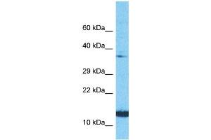 Host:  Rabbit  Target Name:  NINJ1  Sample Type:  PANC1 Whole Cell lysates  Antibody Dilution:  1. (NINJ1 抗体  (N-Term))