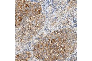 IHC analysis of SNPH using anti-SNPH antibody (ABIN7601724). (Syntaphilin 抗体  (AA 43-482))