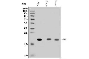 Western blot analysis of SCG10/STMN2 using anti-SCG10/STMN2 antibody (ABIN7600734).