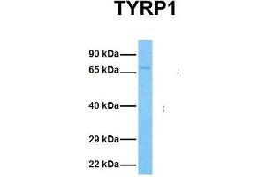Host:  Rabbit  Target Name:  TYRP1  Sample Tissue:  Human 786-0  Antibody Dilution:  1. (Tyrosinase-Related Protein 1 抗体  (Middle Region))