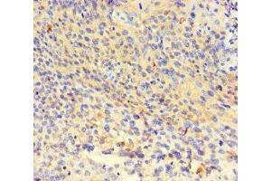 Immunohistochemistry of paraffin-embedded human thyroid tissue using ABIN7162411 at dilution of 1:100 (NR1H3 抗体  (AA 1-402))