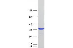 Validation with Western Blot