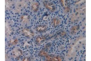 Immunohistochemistry (IHC) image for anti-Lipolysis Stimulated Lipoprotein Receptor (LSR) (AA 335-589) antibody (ABIN7435571)