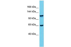 Host: Rabbit  Target Name: Mprip  Sample Tissue: Rat Stomach lysates  Antibody Dilution: 1. (MPRIP 抗体  (Middle Region))