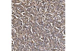 IHC analysis of PI 3 Kinase p85 alpha/PIK3R1 using anti-PI 3 Kinase p85 alpha/PIK3R1 antibody (ABIN7599781).