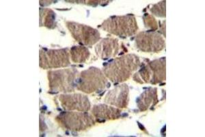 Immunohistochemistry analysis in formalin fixed and paraffin embedded human skeletal muscle reacted withPION / GSAP (C-term) Antibody (C-term) followed by peroxidase conjugation of the secondary antibody and DAB staining. (GSAP 抗体  (C-Term))