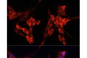 Immunofluorescence analysis of NIH-3T3 cells using ETF1 Polyclonal Antibody at dilution of 1:100 (40x lens). (ETF1 抗体)