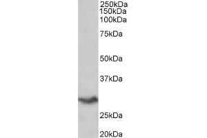 Western Blotting (WB) image for anti-V-Set Domain Containing T Cell Activation Inhibitor 1 (VTCN1) (AA 153-165) antibody (ABIN940573)