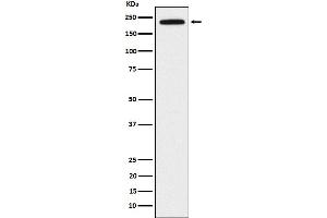 Western blot analysis of DOCK2 expression in Jurkat cell lysate.
