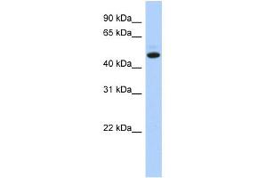 WB Suggested Anti-C5orf36 Antibody Titration: 0. (C5orf36 抗体  (N-Term))