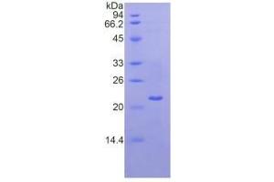 SDS-PAGE analysis of Mouse Laminin gamma 1 Protein. (Laminin gamma 1 蛋白)