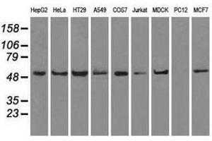 Image no. 6 for anti-ATP Synthase, H+ Transporting, Mitochondrial F1 Complex, beta Polypeptide (ATP5B) antibody (ABIN1496769)
