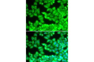 Immunofluorescence analysis of U20S cell using CD40LG antibody. (CD40 Ligand 抗体  (AA 47-223))