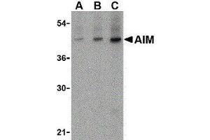 Western Blotting (WB) image for anti-CD5 Molecule-Like (CD5L) (N-Term) antibody (ABIN2472166) (CD5L 抗体  (N-Term))