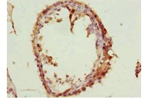 Immunohistochemistry of paraffin-embedded human testis tissue using ABIN7170599 at dilution of 1:100 (Spindlin 1 抗体  (AA 1-262))