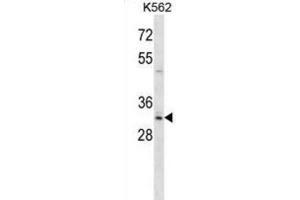 Western Blotting (WB) image for anti-Homeobox B8 (HOXB8) antibody (ABIN2998503) (HOXB8 抗体)