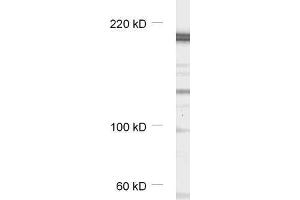 dilution: 1 : 1000, sample: synaptic membrane fraction of rat brain (LP1) (CASKIN1 抗体)